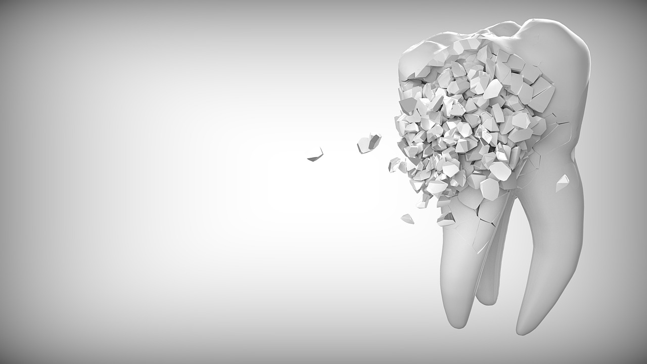 Jak wygląda zabieg implantacji? Protezy zębów dawniej i dziś